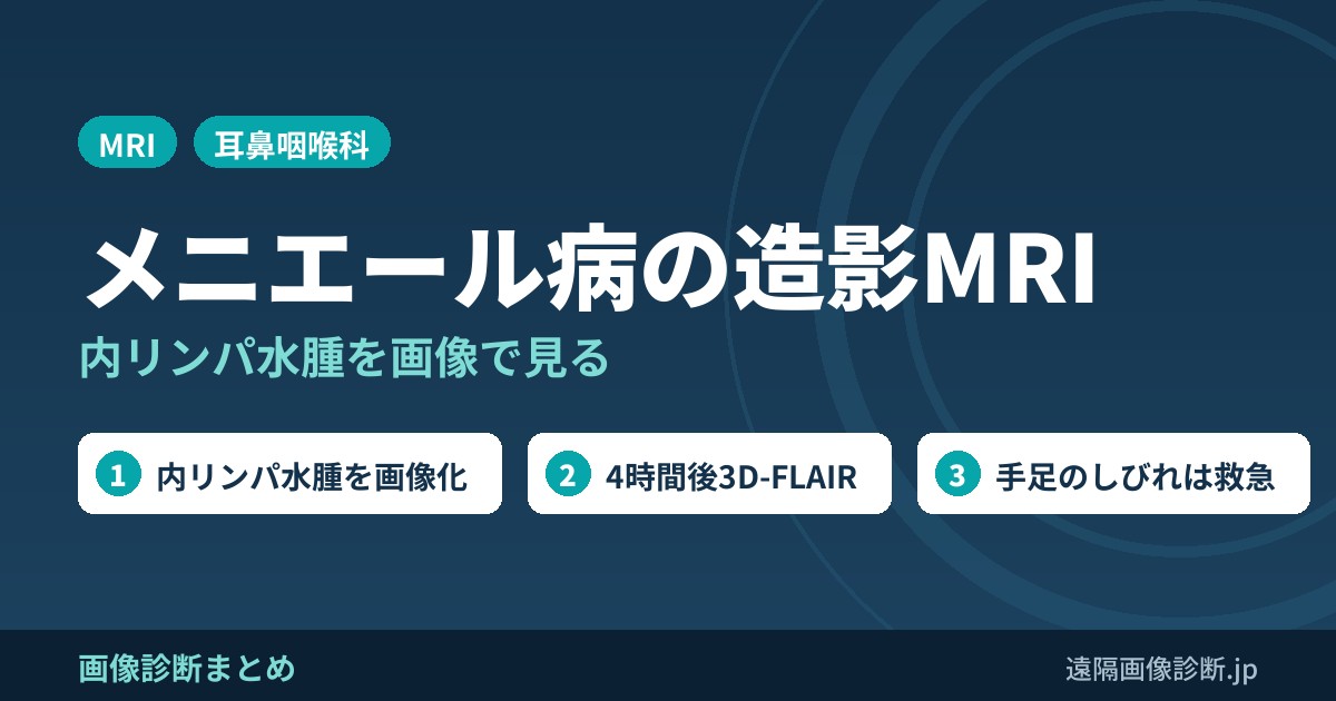 メニエール病の造影MRI 内リンパ水腫を画像で見る