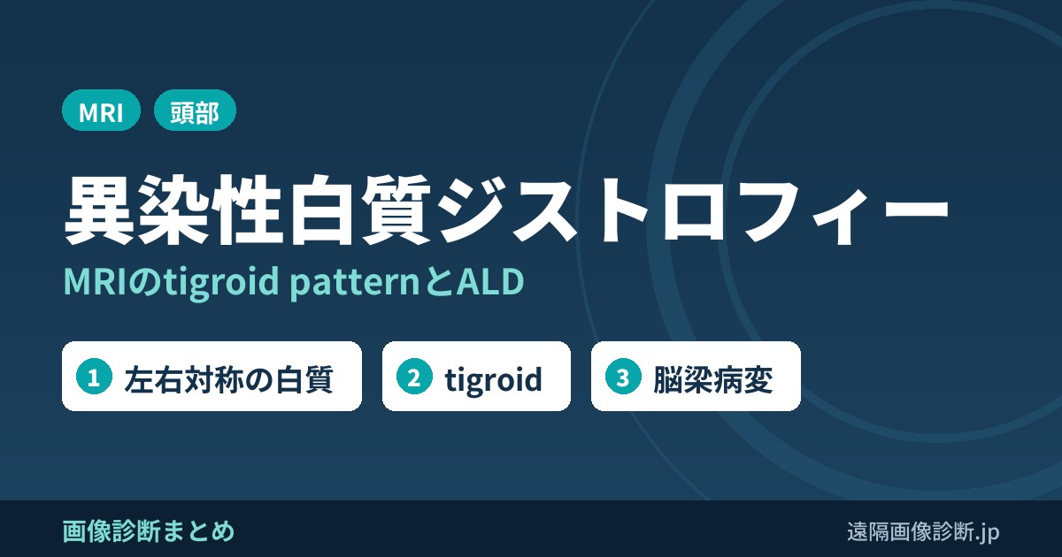 異染性白質ジストロフィー MRIのtigroid patternとALD