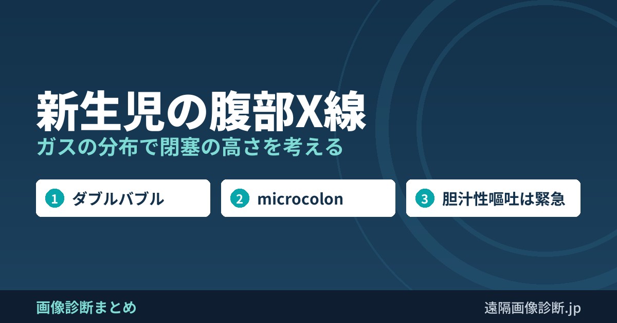新生児の腹部X線 ガスの分布で閉塞の高さを考える
