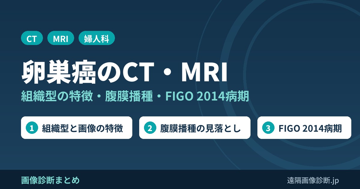 卵巣癌のCT・MRI 組織型の特徴・腹膜播種・FIGO 2014病期