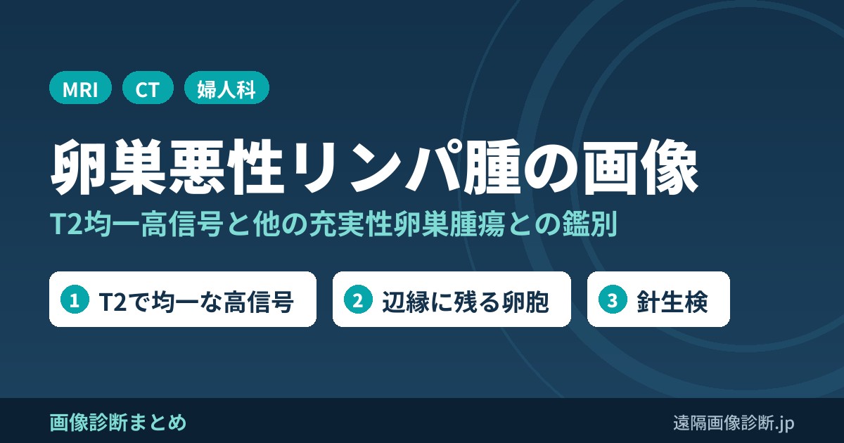 卵巣悪性リンパ腫の画像 T2均一高信号と他の充実性卵巣腫瘍との鑑別