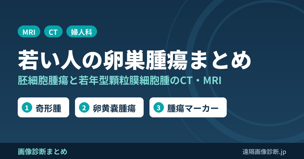 若い人の卵巣腫瘍まとめ 胚細胞腫瘍と若年型顆粒膜細胞腫のCT・MRI
