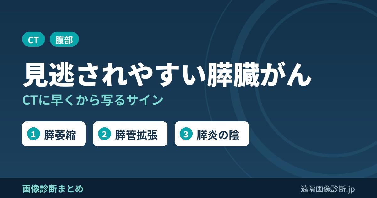 見逃されやすい膵臓がん CTに早くから写るサイン