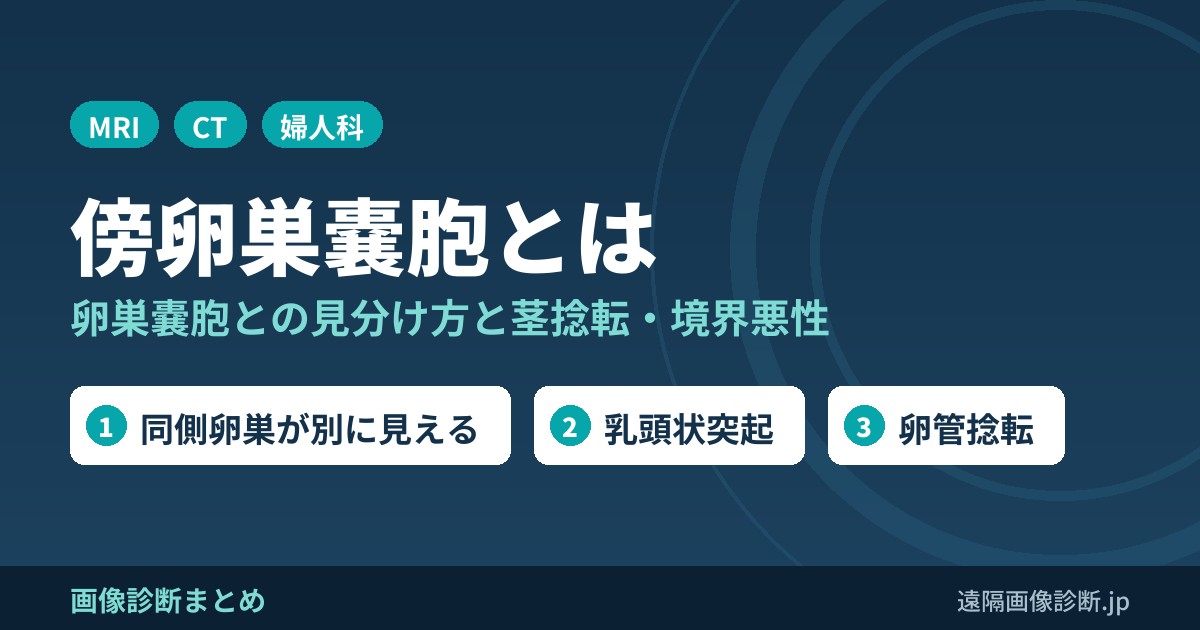傍卵巣嚢胞とは 卵巣嚢胞との見分け方と茎捻転・境界悪性