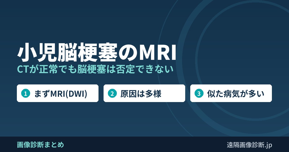 小児脳梗塞のMRI CTが正常でも脳梗塞は否定できない