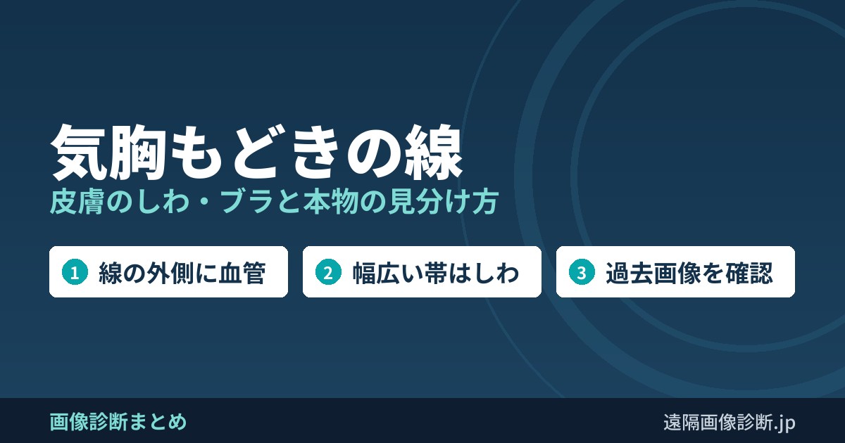 気胸もどきの線 皮膚のしわ・ブラと本物の見分け方
