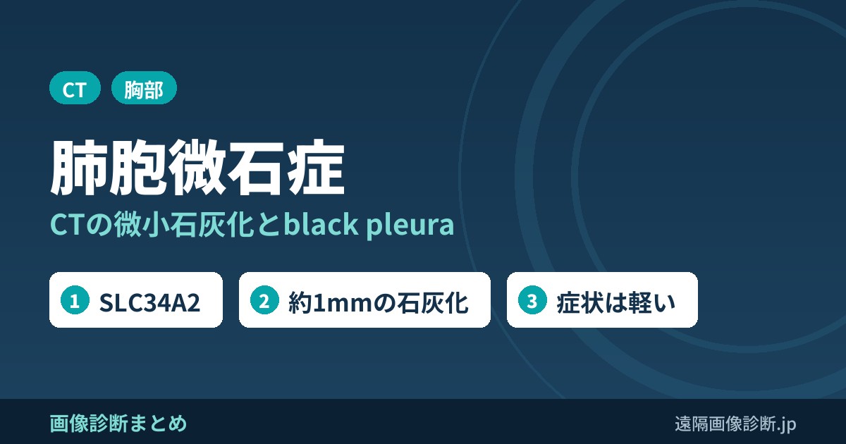 肺胞微石症 CTの微小石灰化とblack pleura