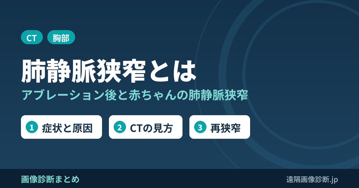 肺静脈狭窄とは アブレーション後と赤ちゃんの肺静脈狭窄