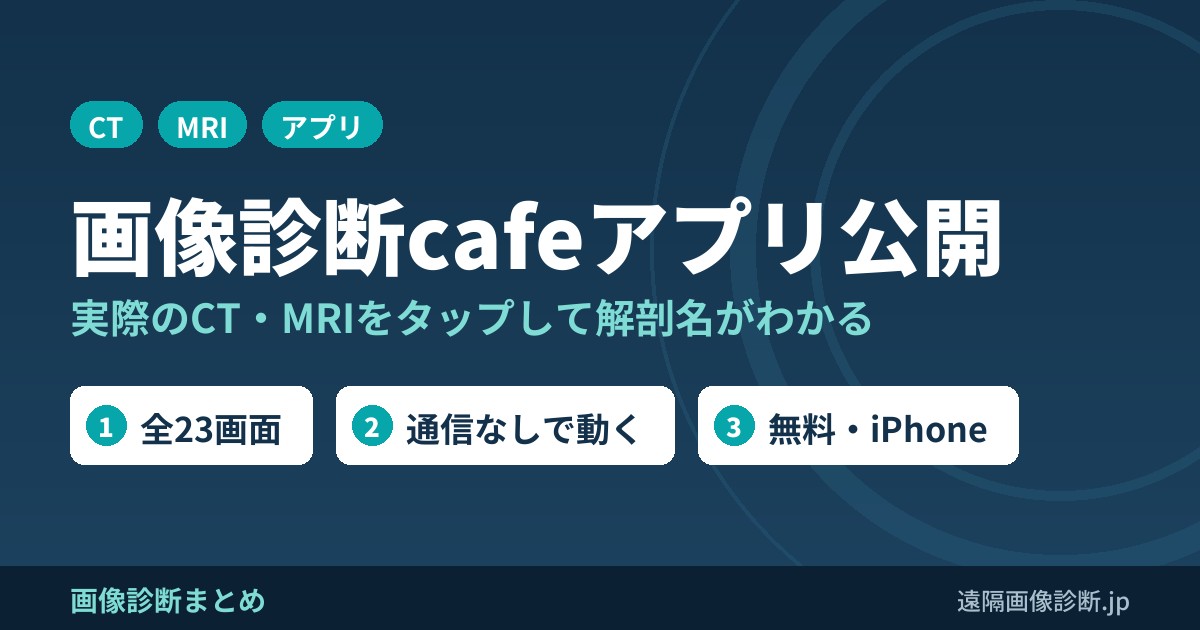 画像診断cafeアプリ公開 実際のCT・MRIをタップして解剖名がわかる