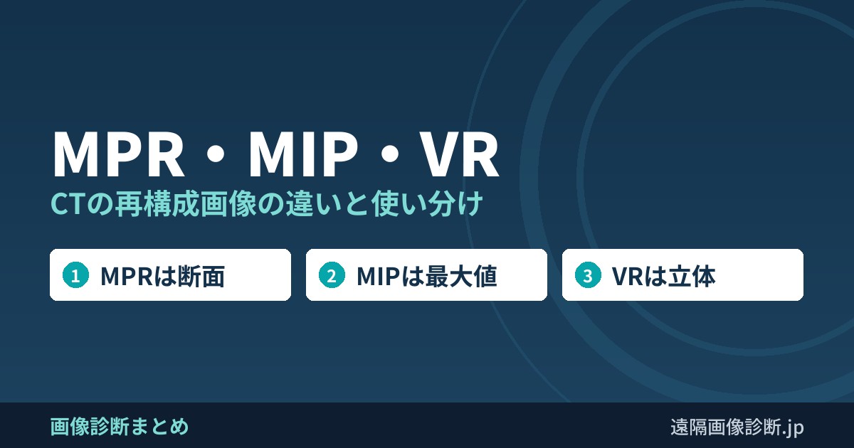 MPR・MIP・VR CTの再構成画像の違いと使い分け