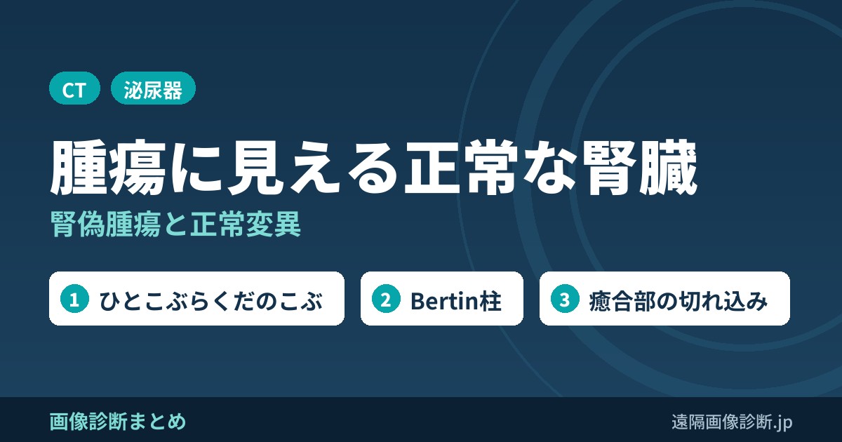 腫瘍に見える正常な腎臓 腎偽腫瘍と正常変異