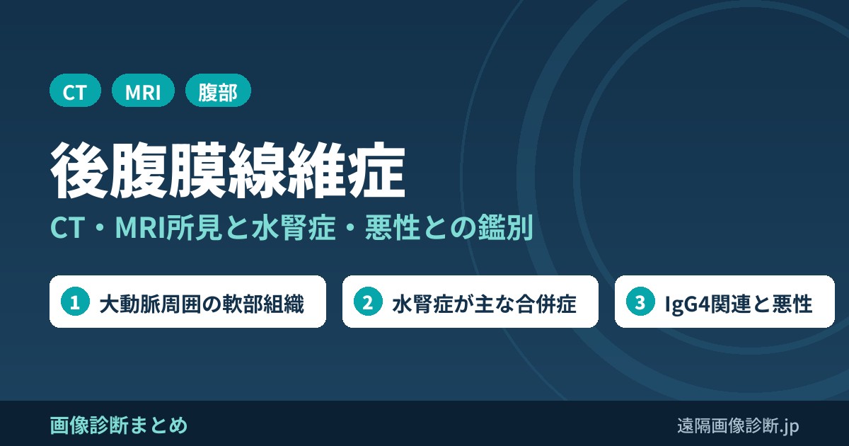 後腹膜線維症 CT・MRI所見と水腎症・悪性との鑑別