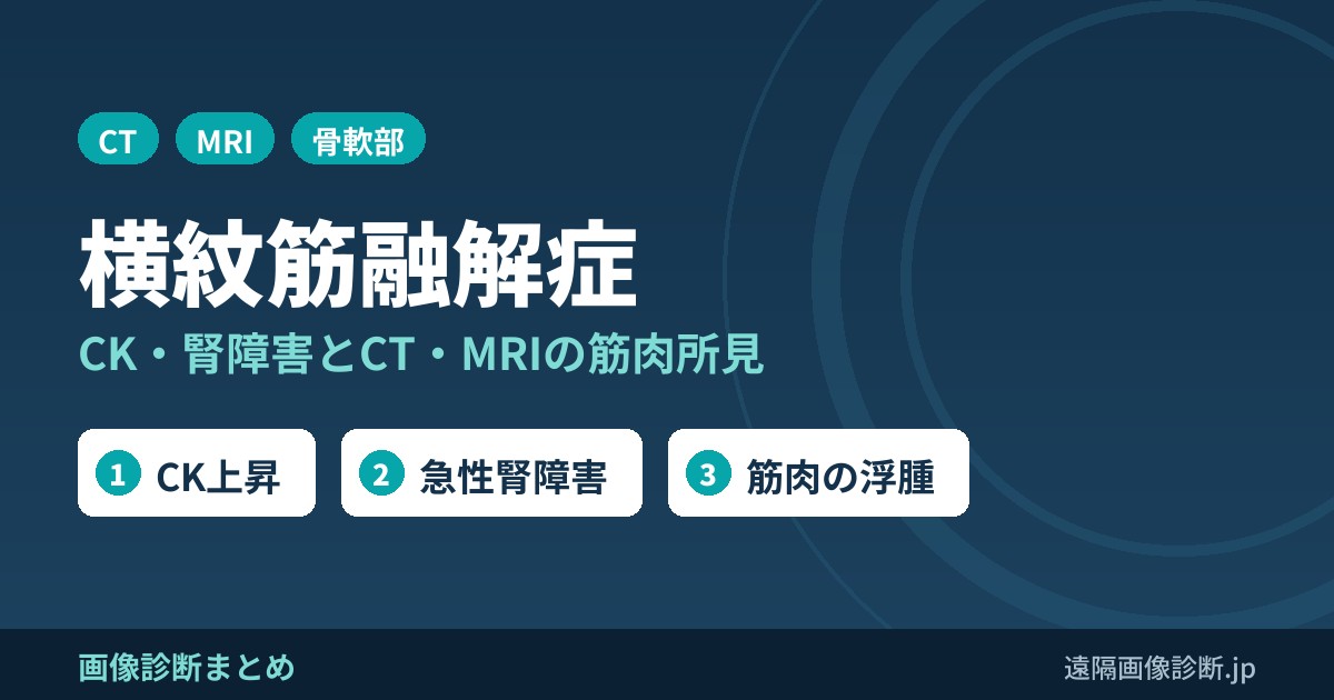 横紋筋融解症 CK・腎障害とCT・MRIの筋肉所見