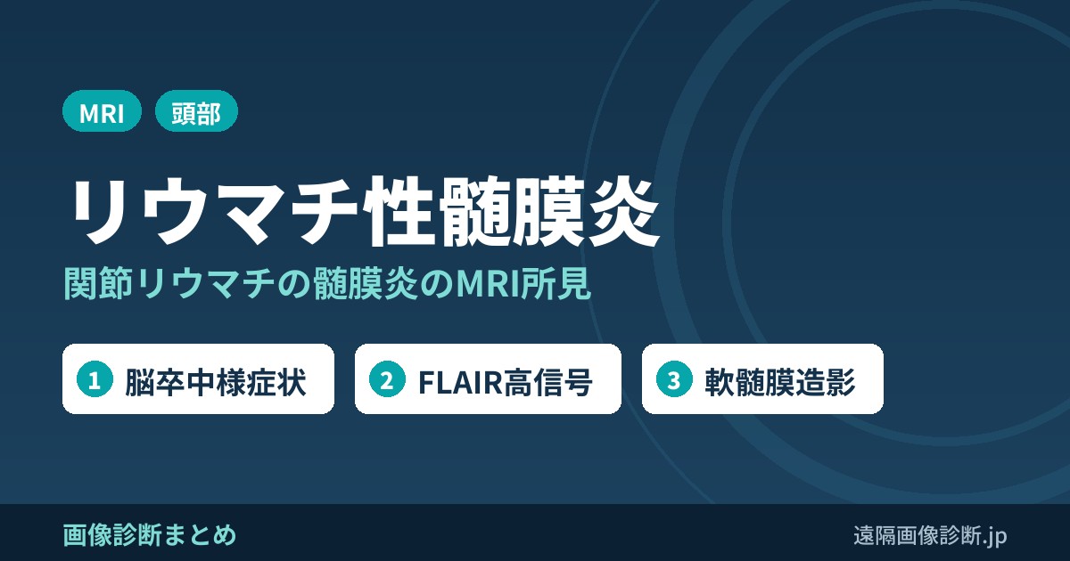 リウマチ性髄膜炎 関節リウマチの髄膜炎のMRI所見