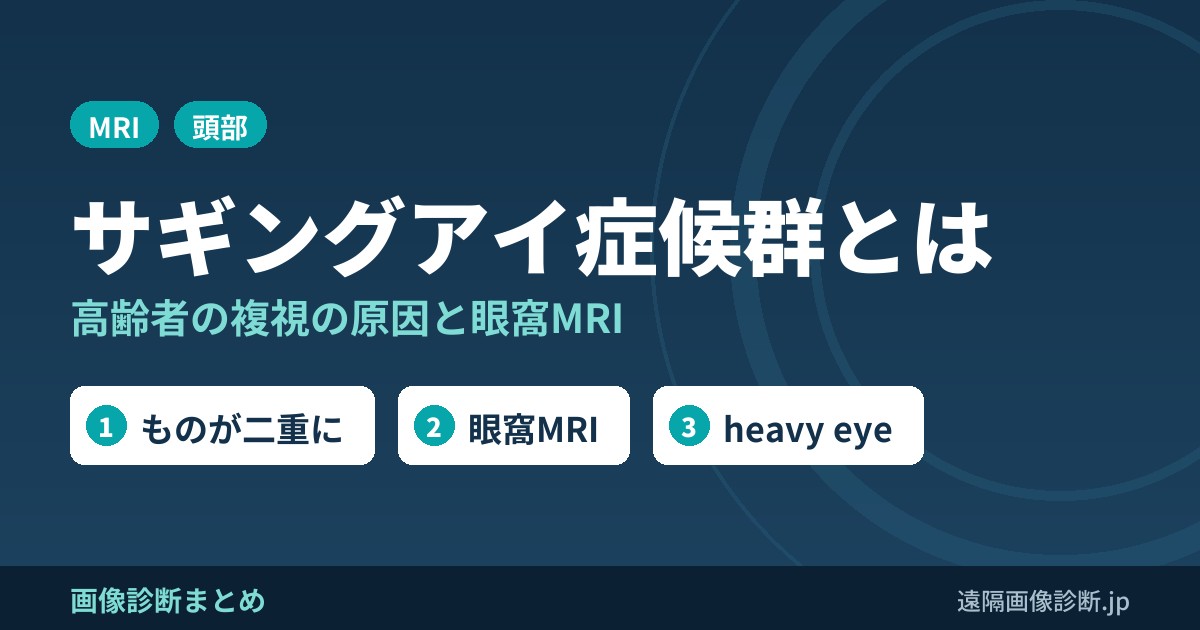 サギングアイ症候群とは 高齢者の複視の原因と眼窩MRI