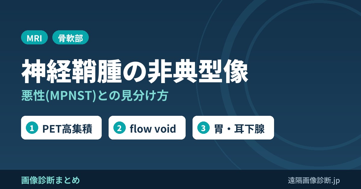 神経鞘腫の非典型像 悪性(MPNST)との見分け方