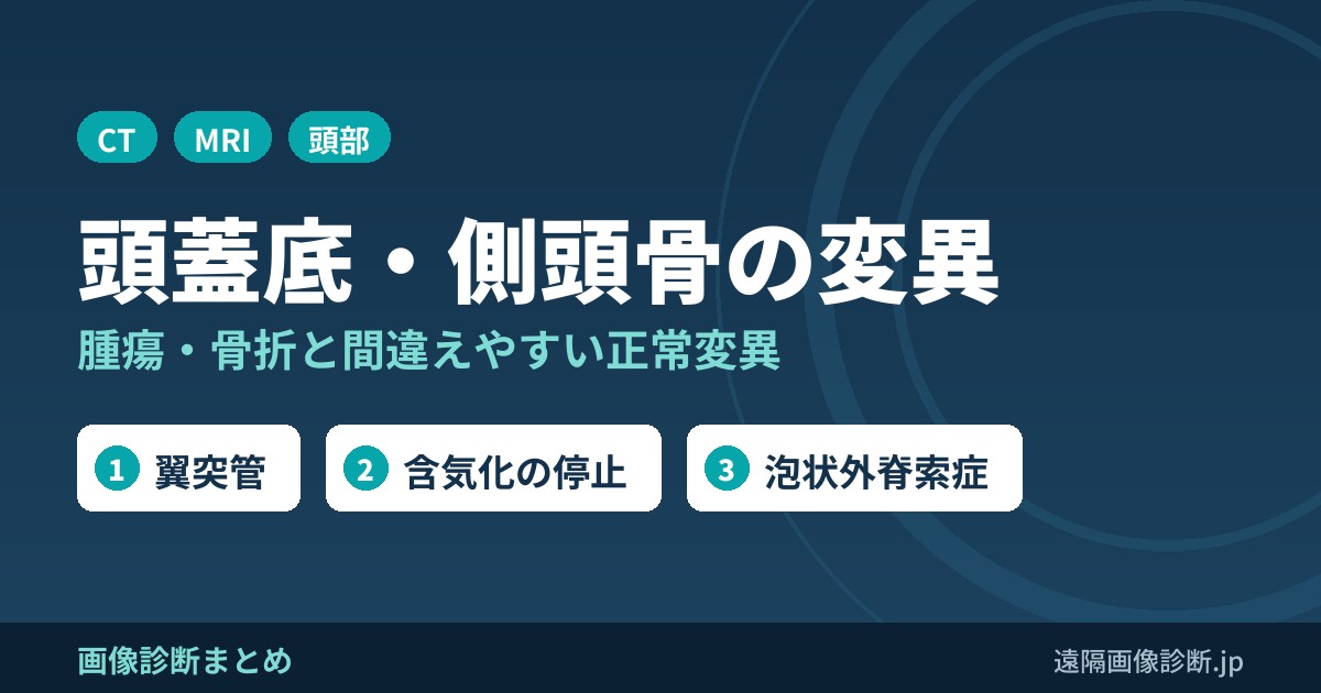 頭蓋底・側頭骨の変異 腫瘍・骨折と間違えやすい正常変異