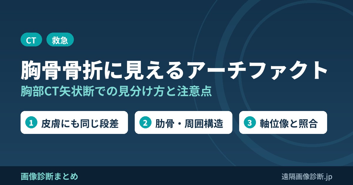 胸骨骨折に見えるアーチファクト 胸部CT矢状断での見分け方と注意点