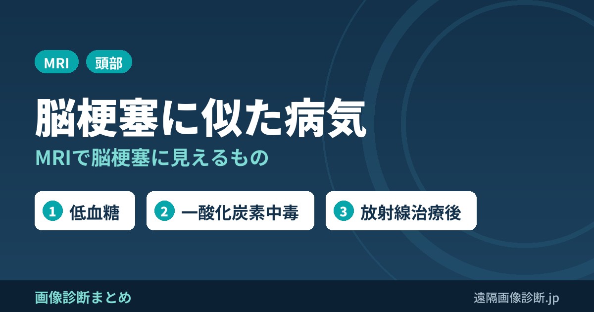 脳梗塞に似た病気 MRIで脳梗塞に見えるもの