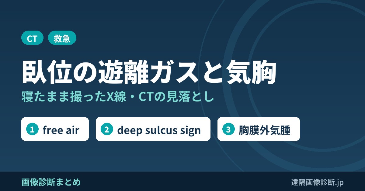 臥位の遊離ガスと気胸 寝たまま撮ったX線・CTの見落とし