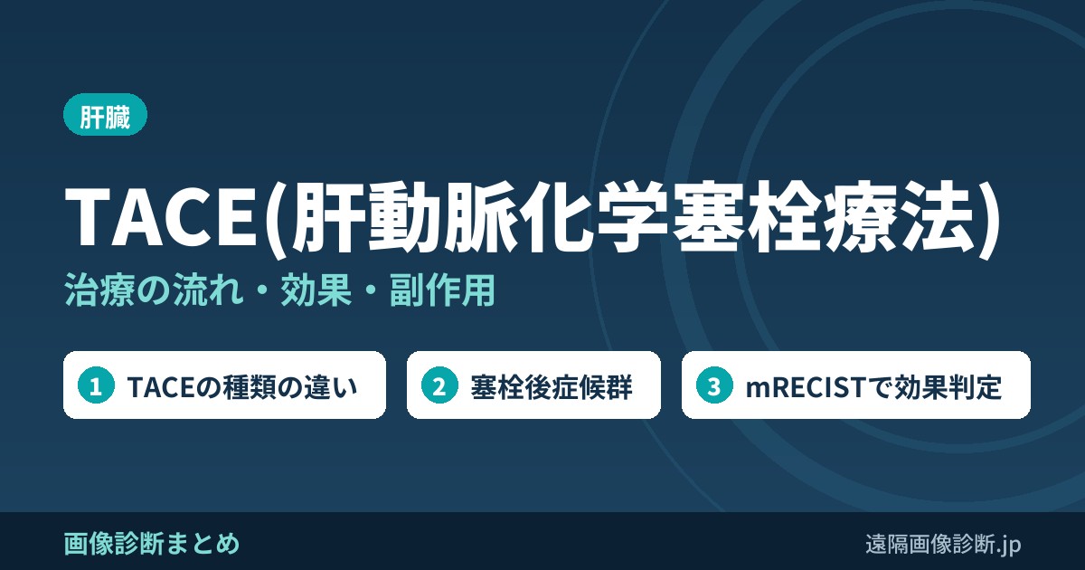 TACE(肝動脈化学塞栓療法) 治療の流れ・効果・副作用