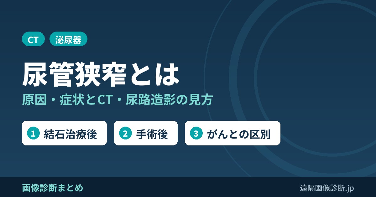 尿管狭窄とは 原因・症状とCT・尿路造影の見方