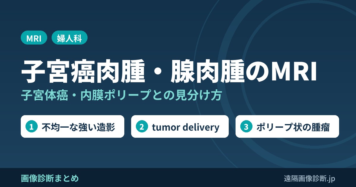 子宮癌肉腫・腺肉腫のMRI 子宮体癌・内膜ポリープとの見分け方