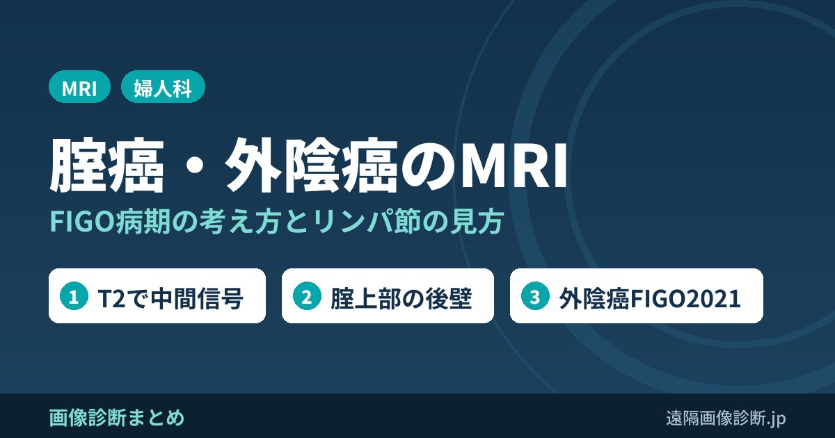 腟癌・外陰癌のMRI FIGO病期の考え方とリンパ節の見方